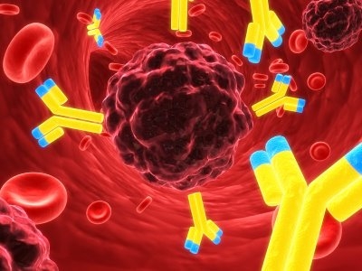 Leucemia mieloide cronica, la Commissione Europea approva il trattamento con bosutinib