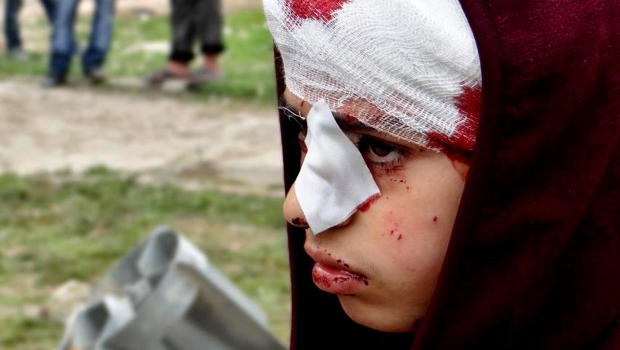 Siria. Human Right Watch, Assad ha usato armi chimiche