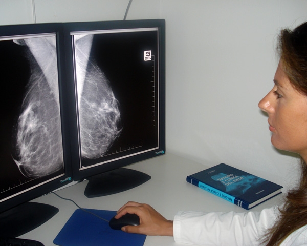 Usa. Si diffonde la mammografia 3D per rilevare i tumori al seno