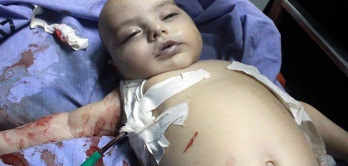 Gaza. Sale il bilancio delle vittime palestinesi a 637. Più di 4mila feriti
