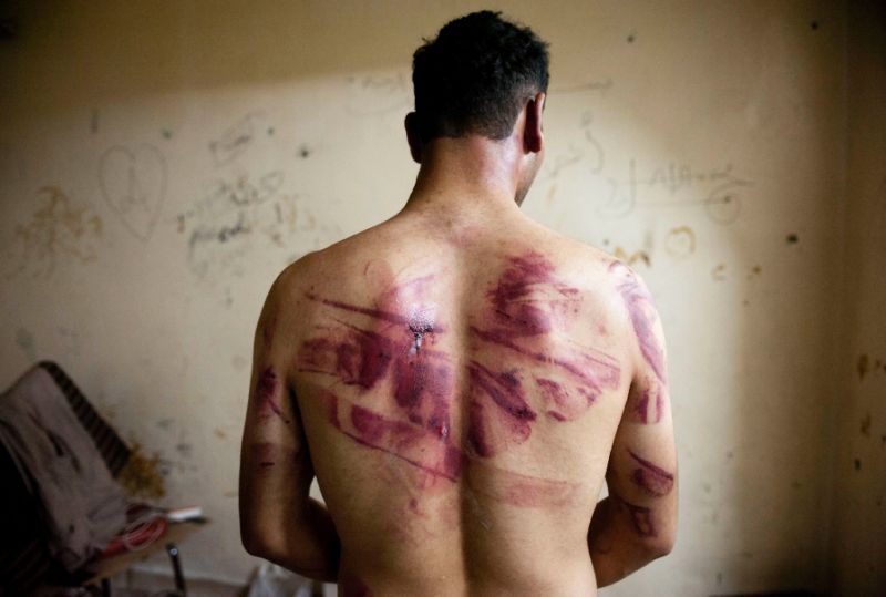 Siria. Rapimenti e torture. La denuncia di Amnesty
