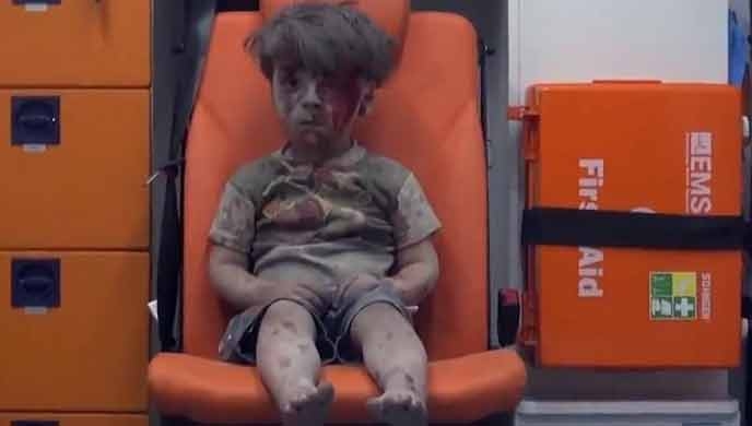 Siria, Omran, il volto innocente della guerra