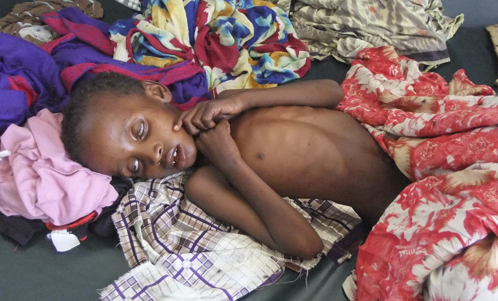 Sofferenza alimentare: colpisce più di 100 milioni di persone