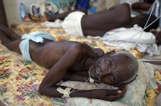 Oms, si aggrava bilancio epidemia colera nello Yemen: 345 morti