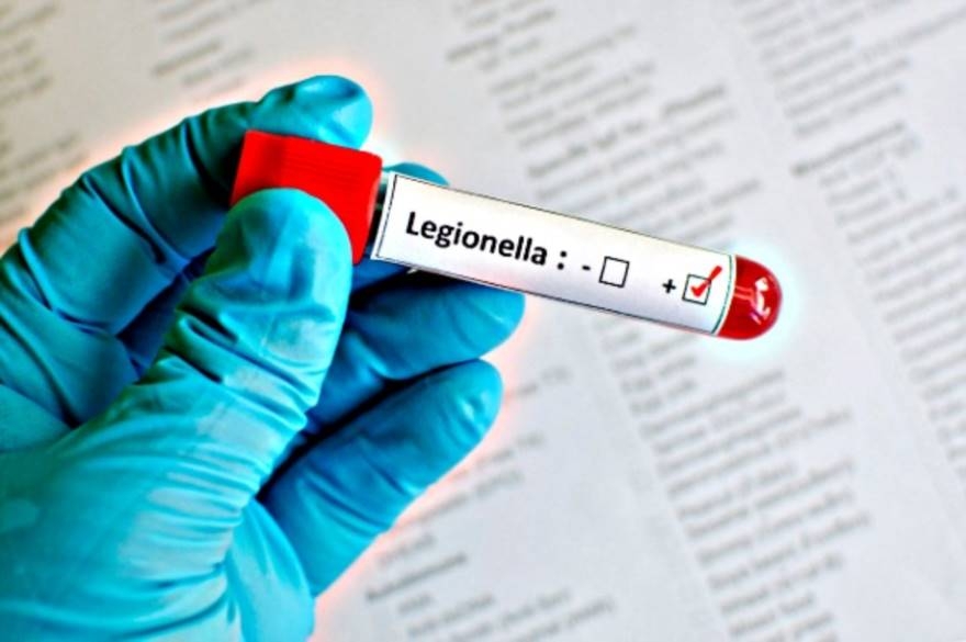 Legionella: come arginarla con l’ozono