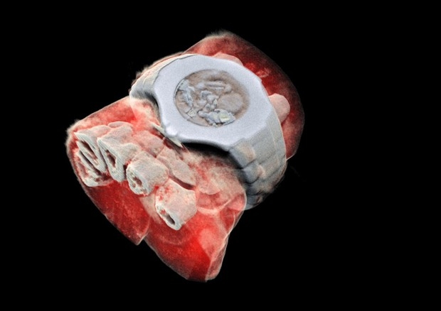 Dalla Nuova Zelanda la prima radiografia in 3D a colori