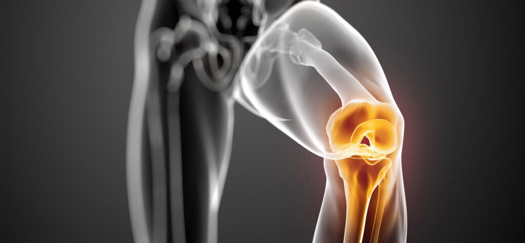 Dall’Università di Bologna la protesi che rigenera tendini e legamenti danneggiati