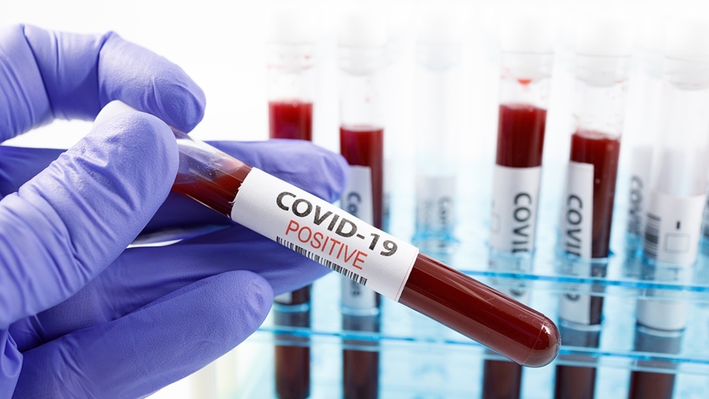 Covid-19: prevedere il decorso analizzando il sangue
