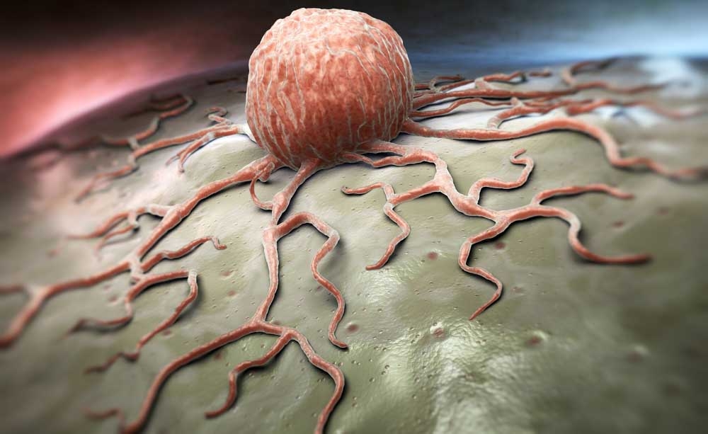Nuova luce sulla divisione cellulare nei tumori