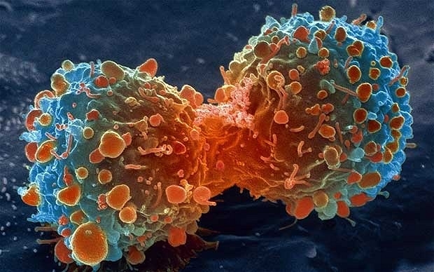 Ricerca. Mirare alle “cellule abilitanti” per fermare la diffusione del cancro al seno