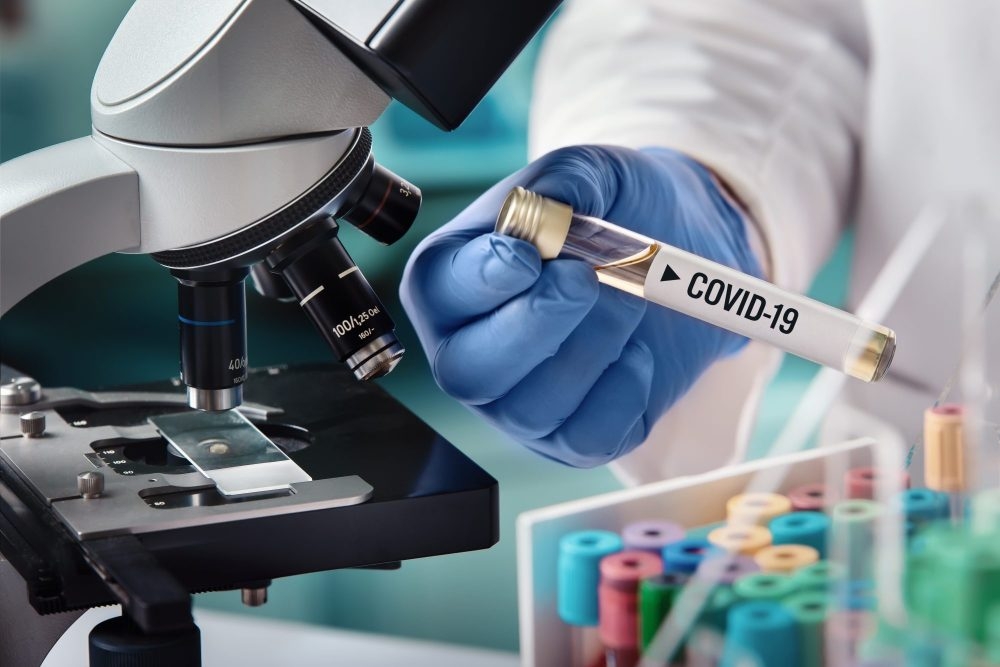 Ricerca Covid: un nuovo studio per farmaco antivirale