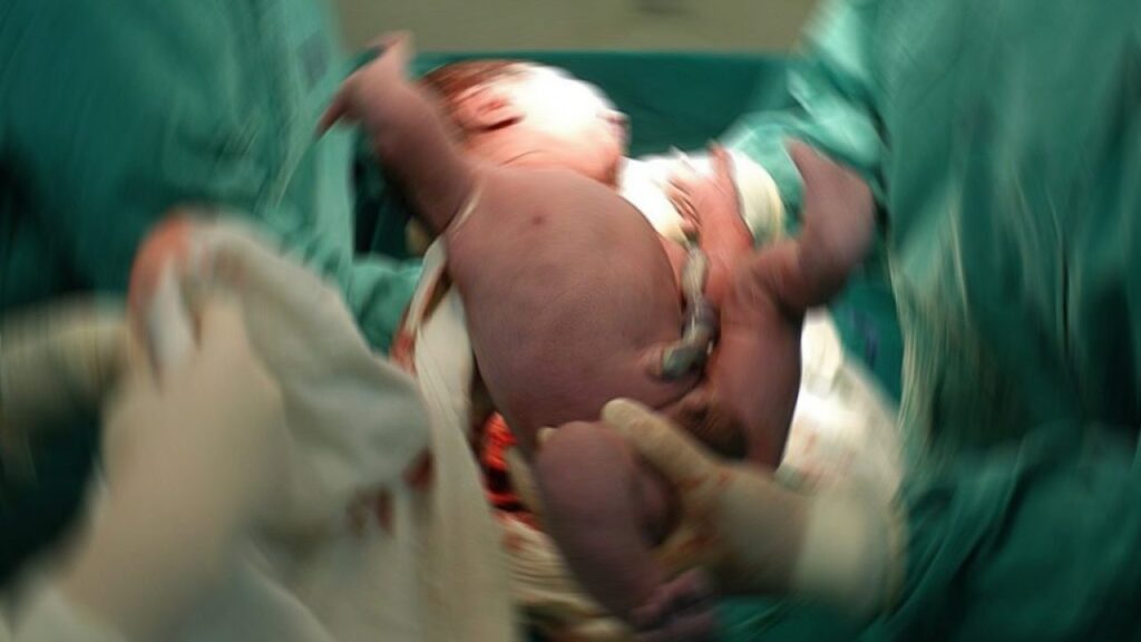 Medicina. A Catania nata la bimba dal primo trapianto di utero in Italia