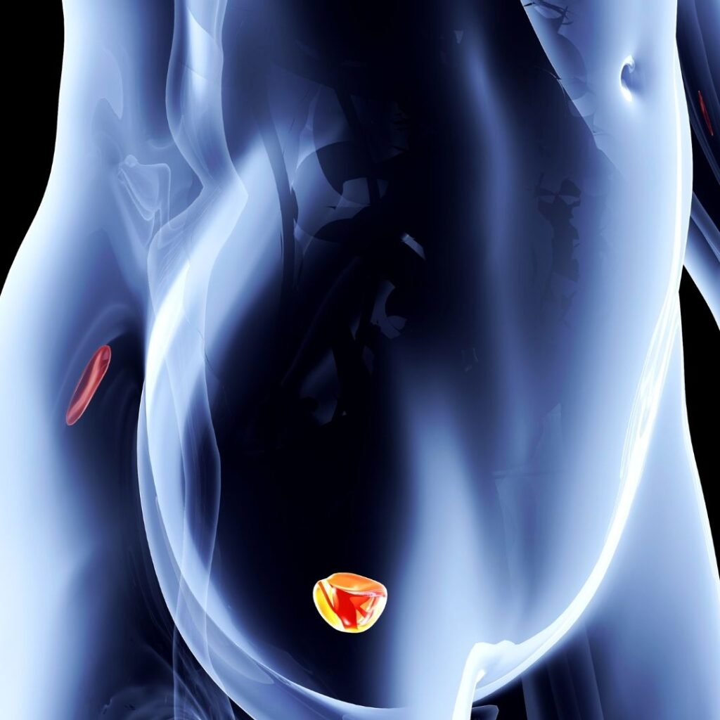 Ricerca. Tumore della prostata: tra le possibili cause l’infiammazione cronica