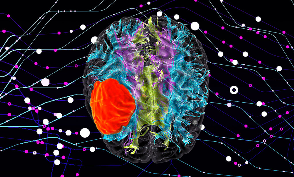 Imaging satellitare e AI: un nuovo approccio per le terapie antitumorali personalizzate