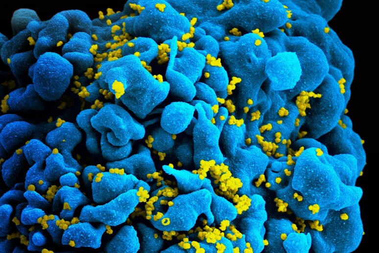Farmaci anti-HIV contro infezioni batteriche e sepsi
