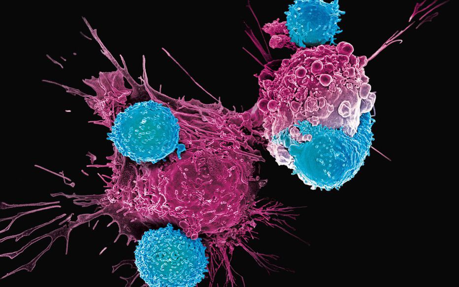 Terapie CAR-T: una rivoluzione nella lotta contro il cancro