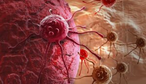 Carcinomi: tipologie, patologie e le terapie del futuro