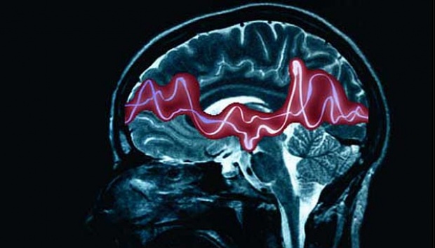 Epilessia pediatrica: nuove speranze contro la DEE1