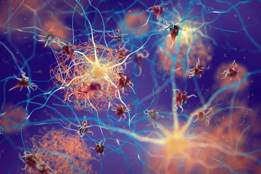 Alzheimer: il ruolo del gene ABCA7