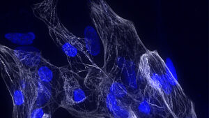 Scoperto un nuovo gene chiave per la salute del cuore: lo studio Sapienza–Cnr apre a diagnosi e terapie innovative