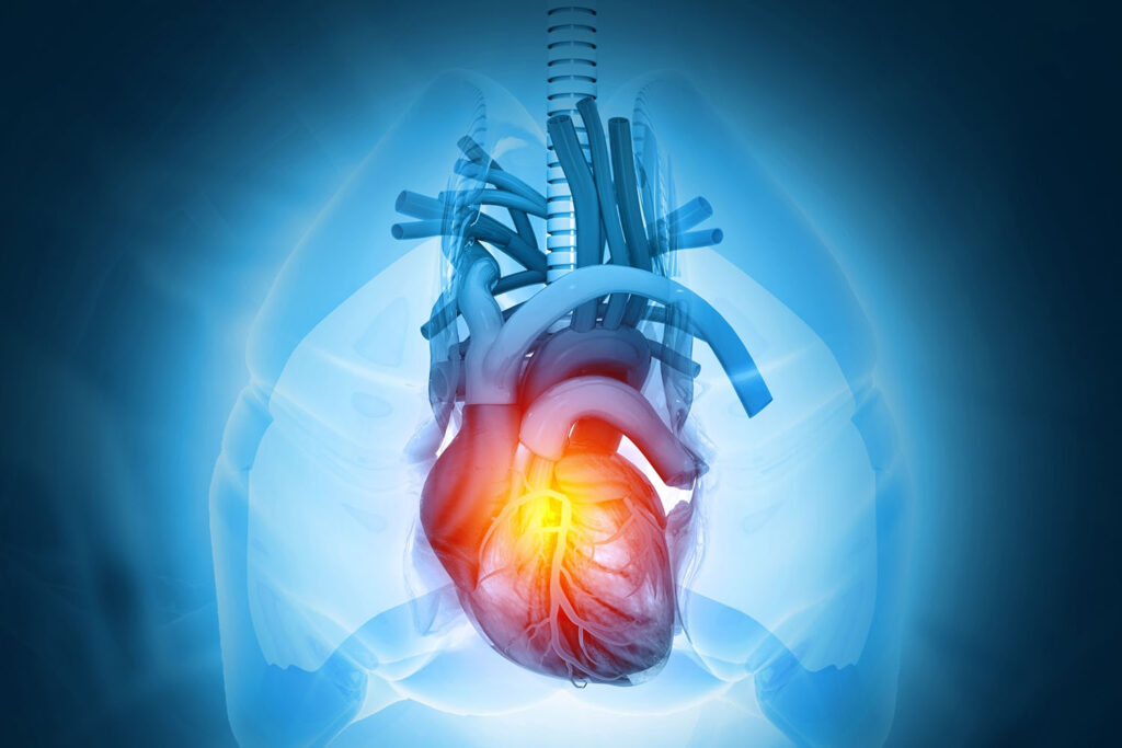Svelato come la fibrosi cardiaca favorisce le aritmie
