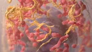 Melanoma metastatico: una nuova strategia per bloccare la sopravvivenza delle cellule tumorali nei linfonodi