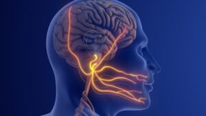 Terapia genica per la nevralgia del trigemino