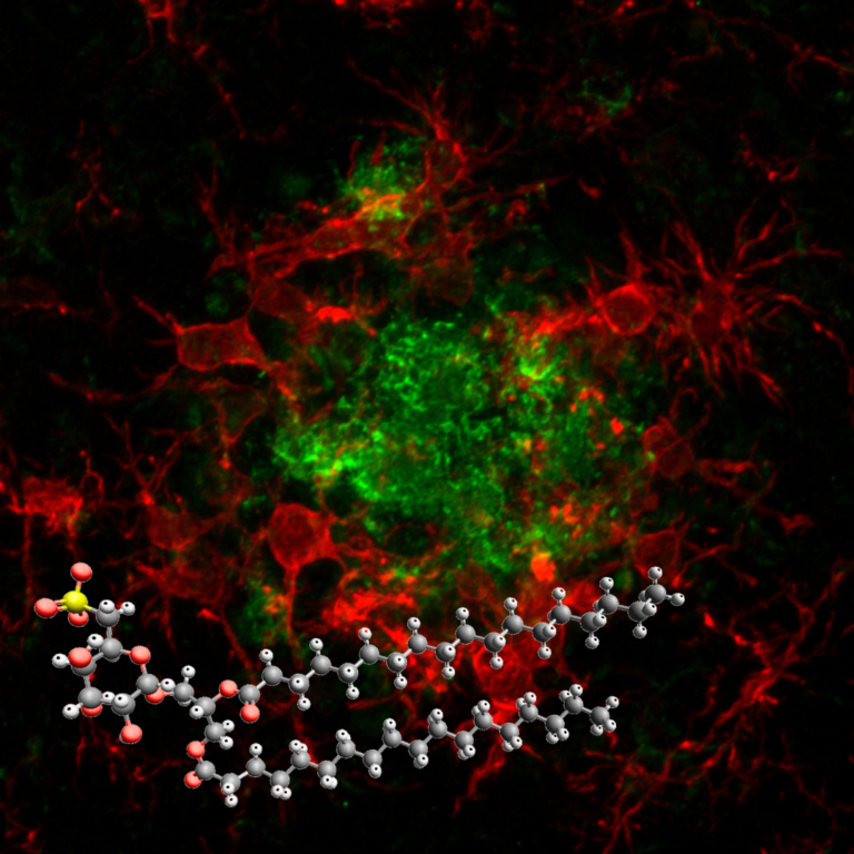 Alzheimer, una “molecola smart” rafforza le difese naturali del cervello