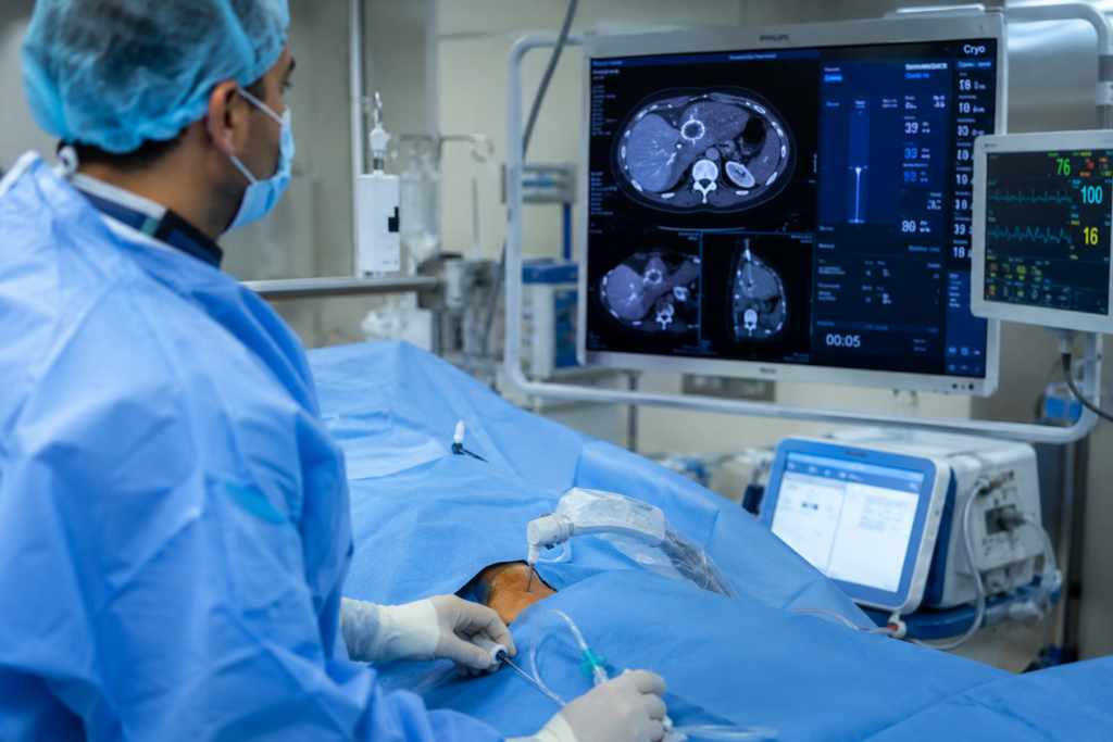Crioablazione in medicina, cos’è e come funziona