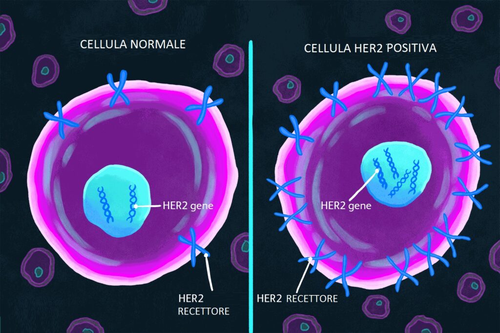 Biopsia liquida e tumore al seno avanzato: cure più mirate
